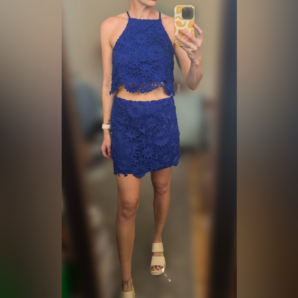 Scalloped Lace Set - Top & Skirt